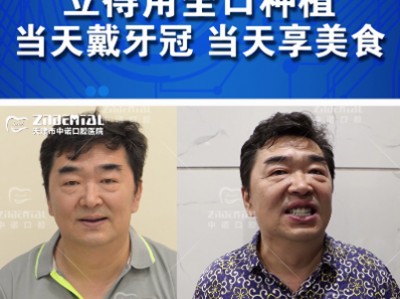 天津市中诺口腔医院收费平价 “立得用”让全口缺牙老人大饱口福